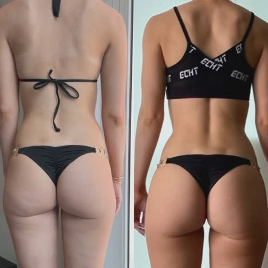 Transformation 5